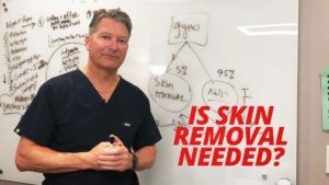 When Is Skin Removal Needed?