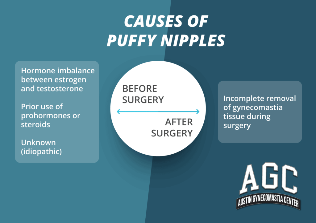infographic showing causes of puffy nipples after gynecomastia surgery