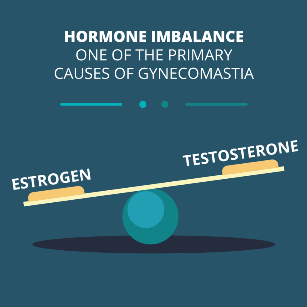 gynecomastia hormone imbalance