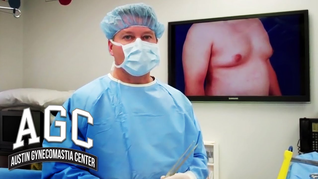 Liposuction vs. Gynecomastia surgery video