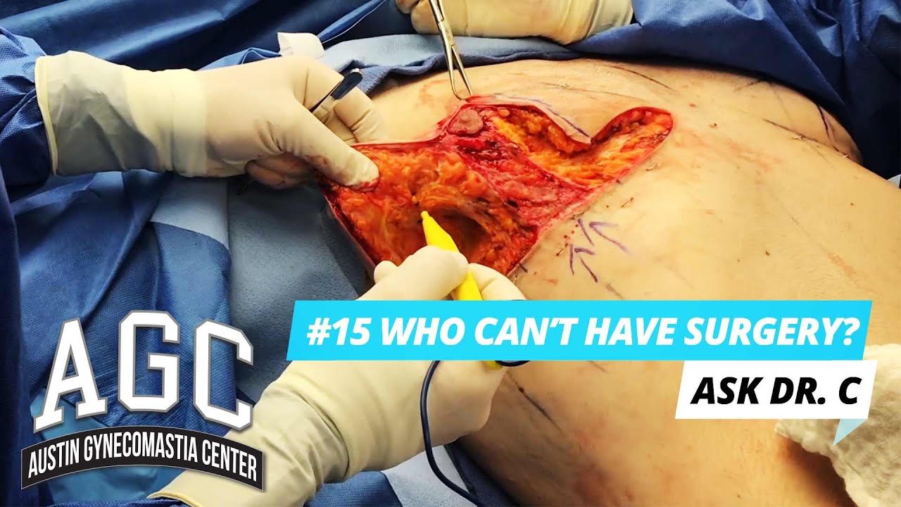 Who can't have Gynecomastia surgery? Video