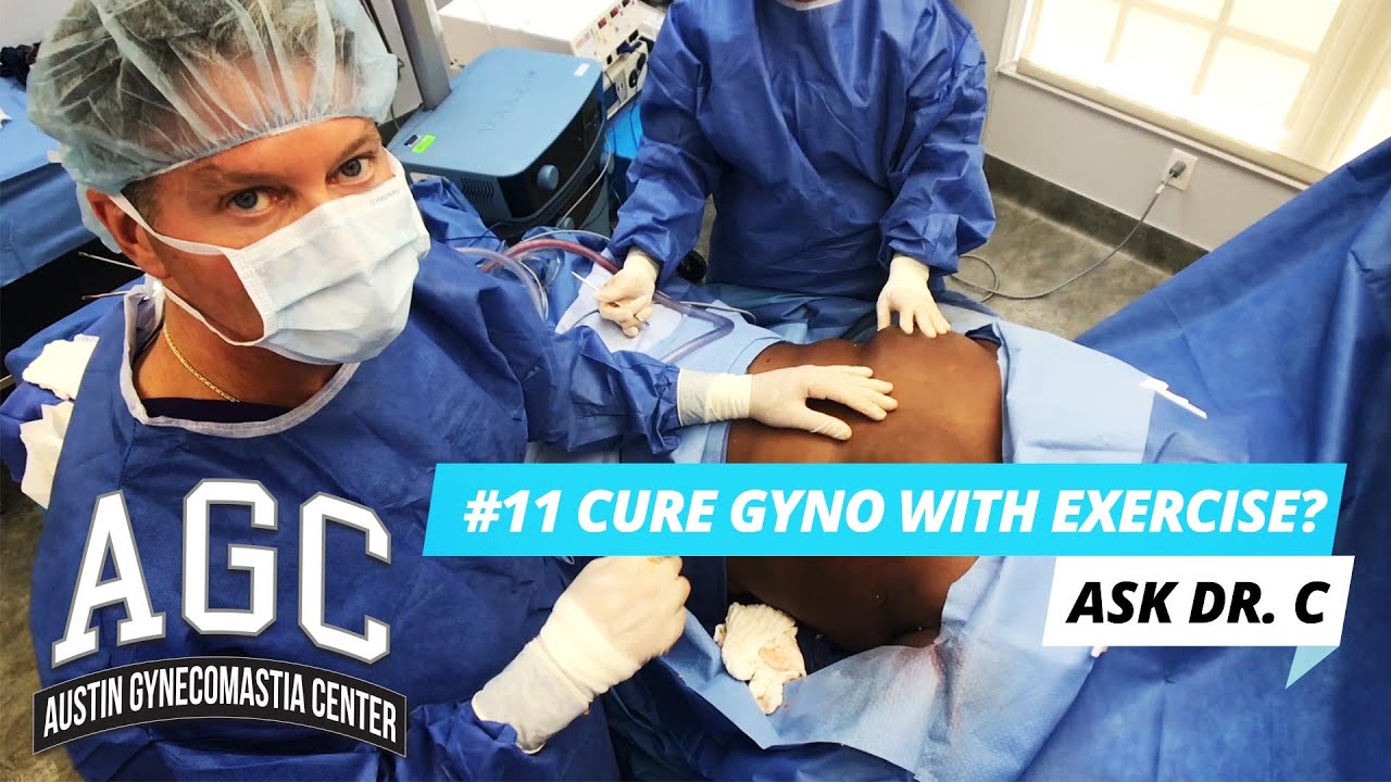 Cure Gynecomastia with exercise? Video
