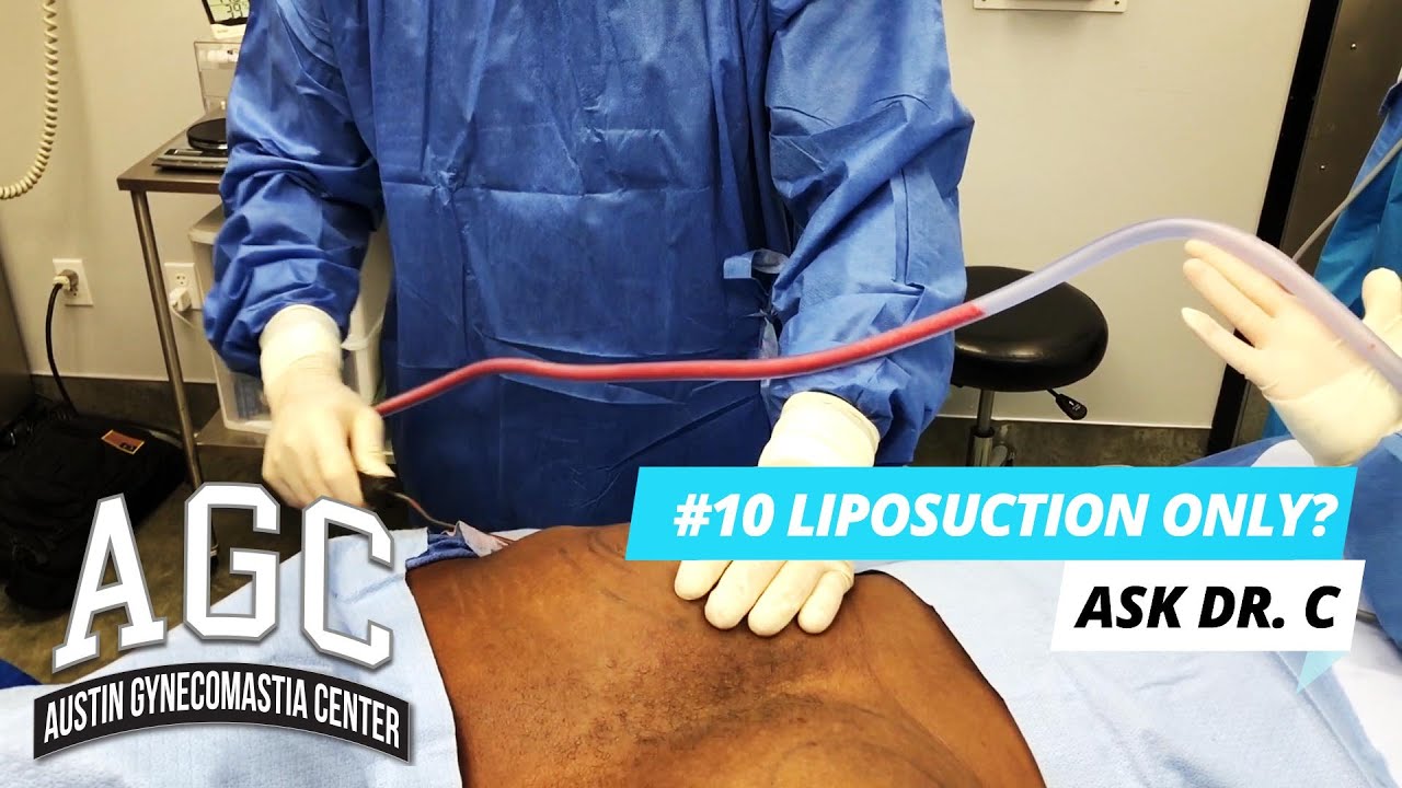 Liposuction only? Video