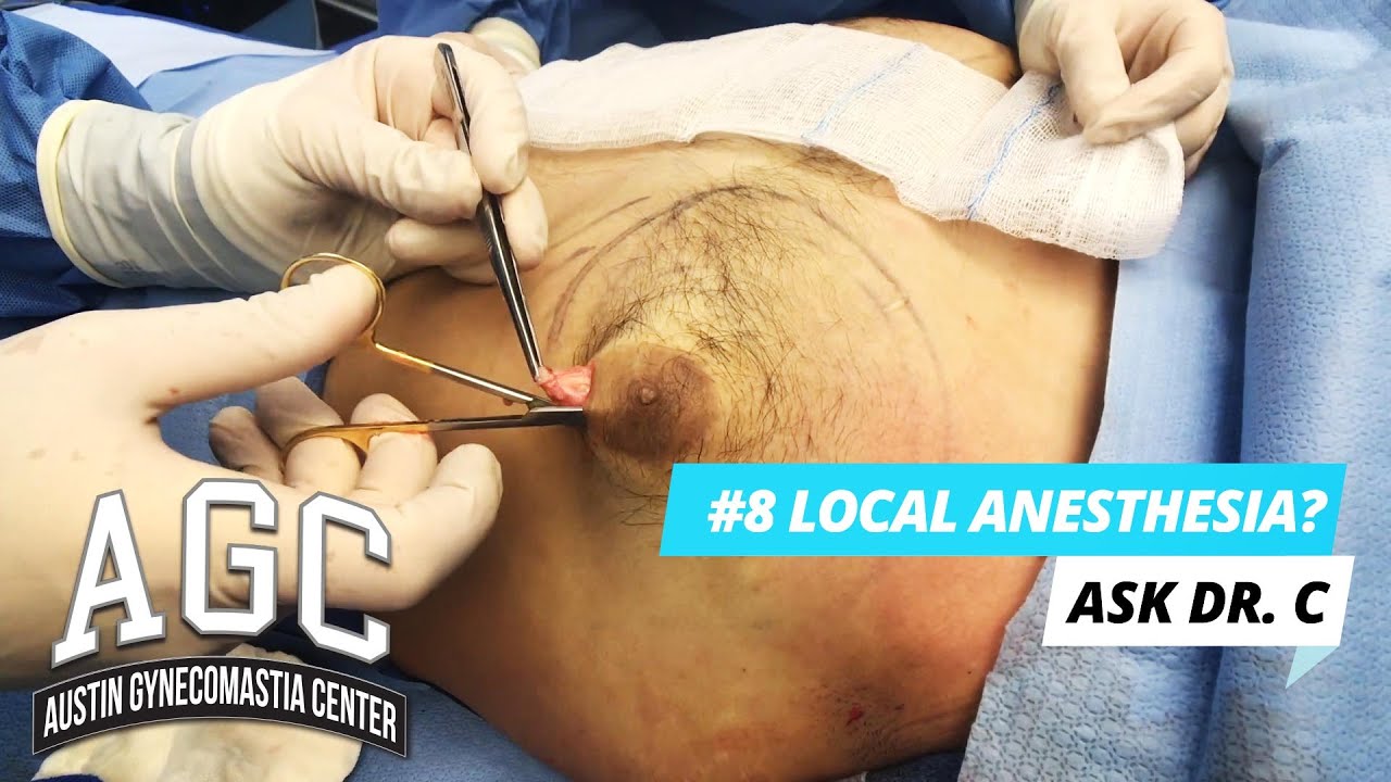Local anesthesia? Video