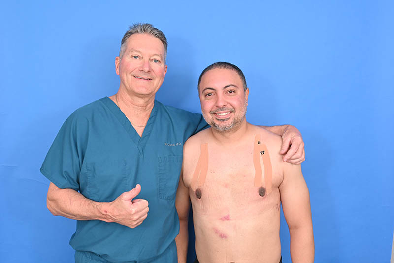 Gynecomastia Surgery Before & After Image